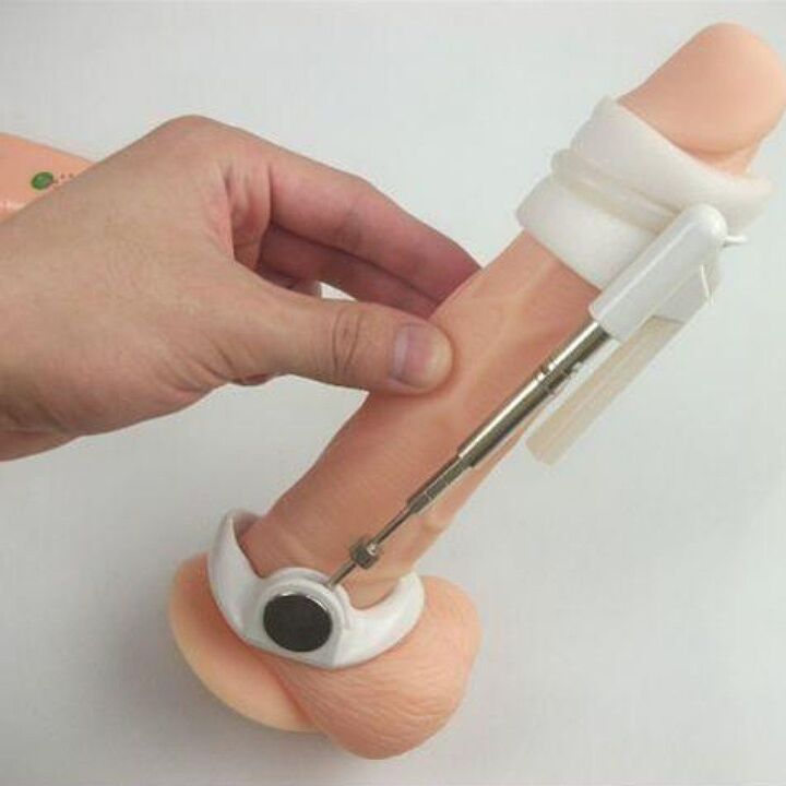 A stretcher will help increase the size of the penis without creams
